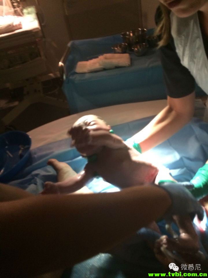 剖腹产全程拍摄，看完后震惊了！附澳洲生产经验(请转给需要的人) ...