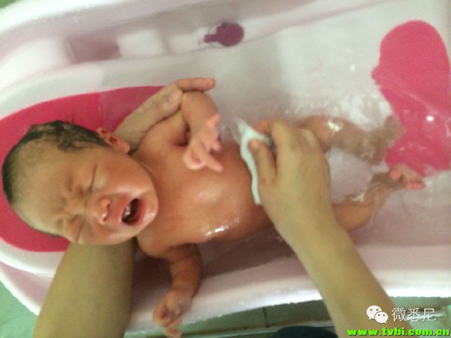 剖腹产全程拍摄，看完后震惊了！附澳洲生产经验(请转给需要的人) ...