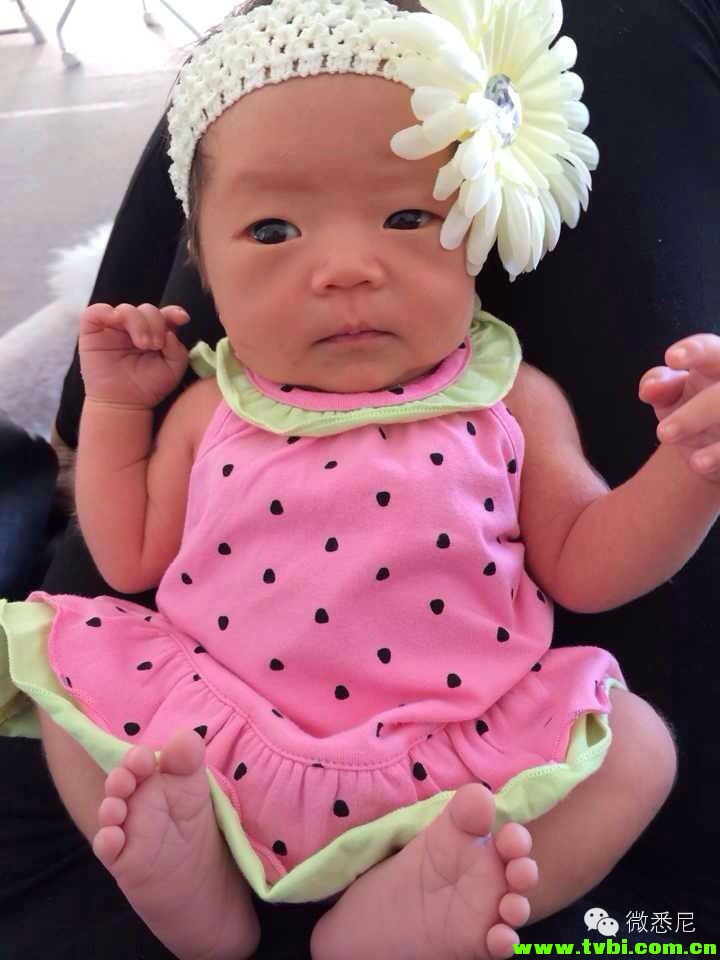 剖腹产全程拍摄，看完后震惊了！附澳洲生产经验(请转给需要的人) ...